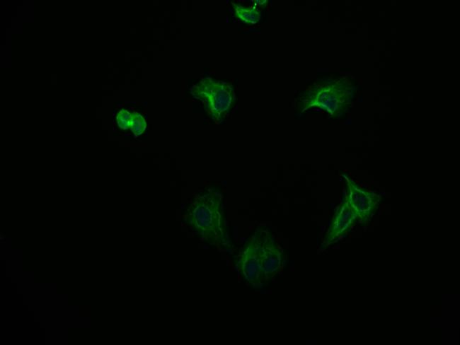 FADS1 Antibody in Immunocytochemistry (ICC/IF)