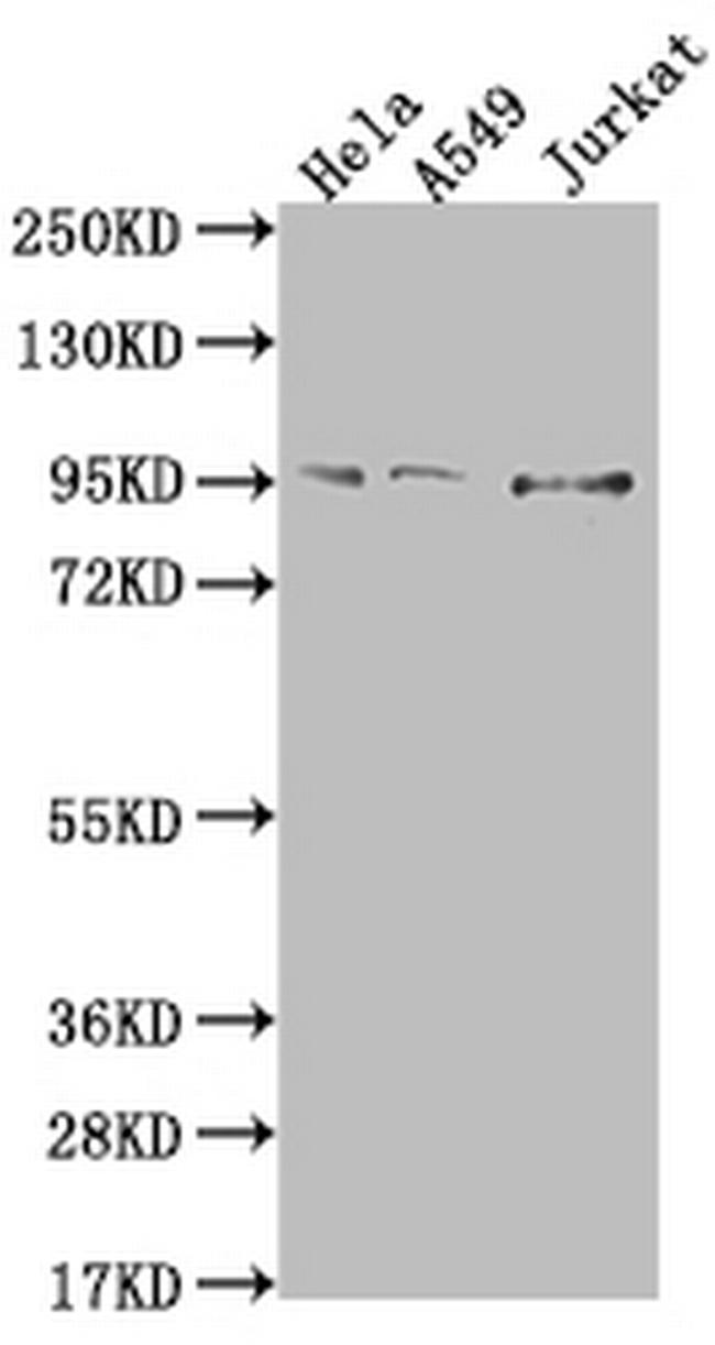 CARS Antibody in Western Blot (WB)