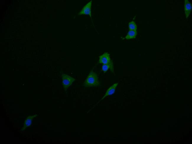 PAH Antibody in Immunocytochemistry (ICC/IF)