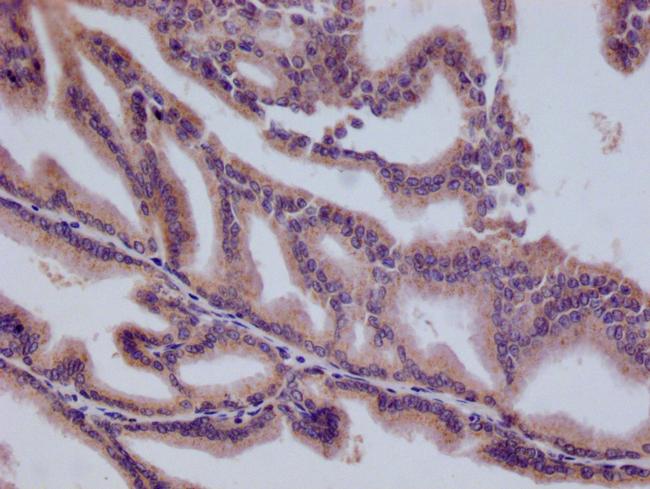 HMGCL Antibody in Immunohistochemistry (Paraffin) (IHC (P))