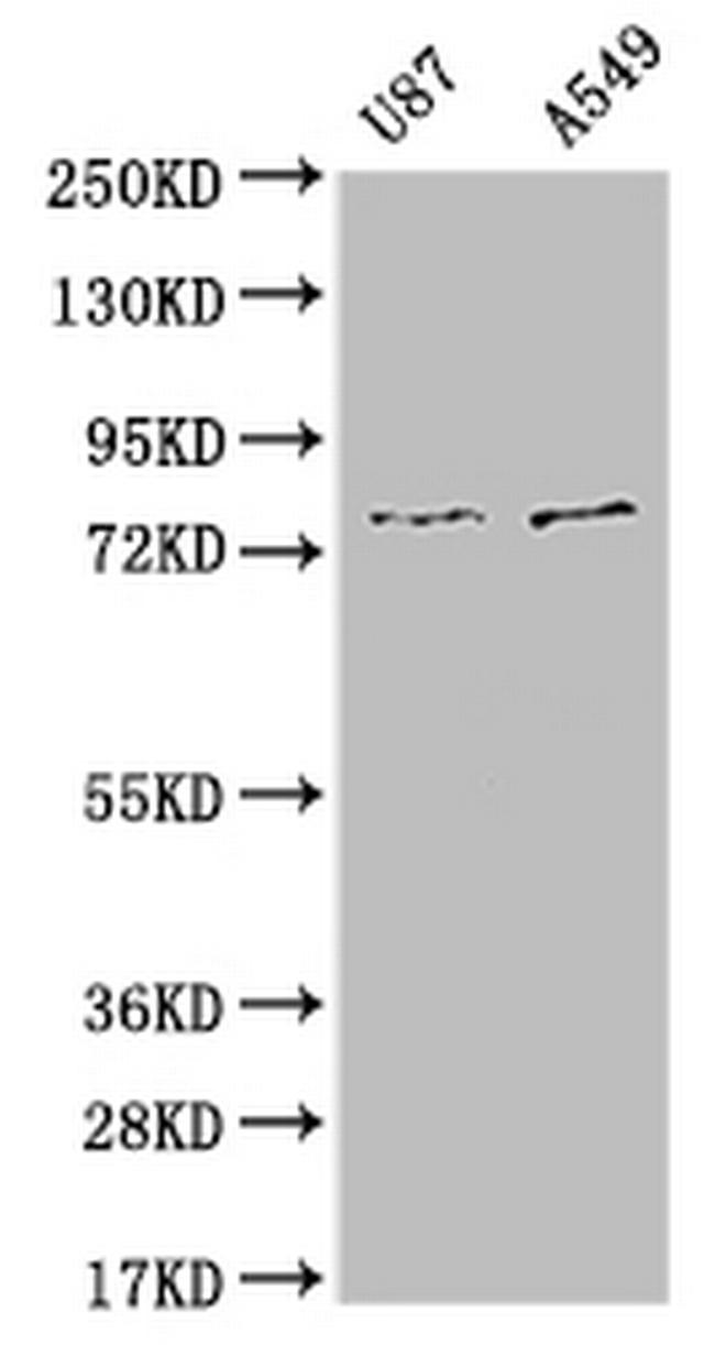 SLC25A12 Antibody in Western Blot (WB)