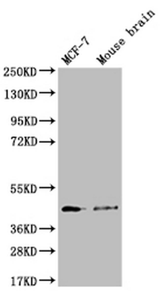 SLC27A4 Antibody in Western Blot (WB)