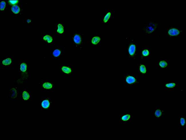 H3K9me1 Antibody in Immunocytochemistry (ICC/IF)