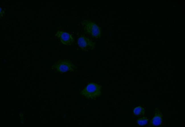 TK1 Antibody in Immunocytochemistry (ICC/IF)