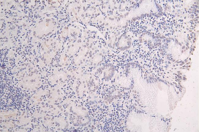 Phospho-Tau (Ser199) Antibody in Immunohistochemistry (Paraffin) (IHC (P))