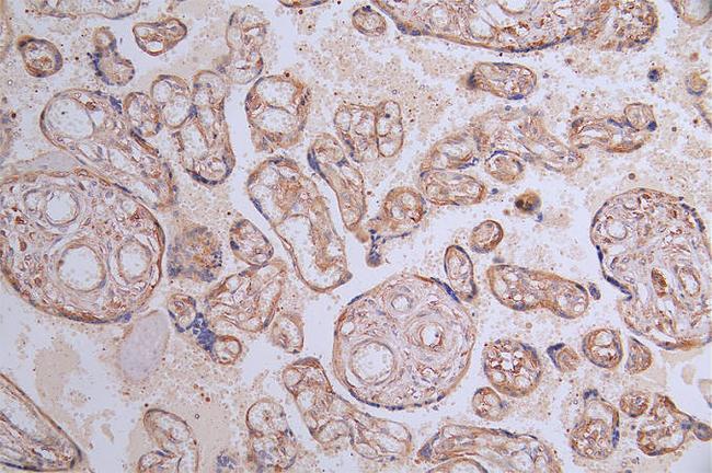 VEGF Receptor 1 Antibody in Immunohistochemistry (Paraffin) (IHC (P))