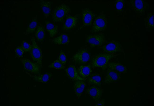 Npr2 Antibody in Immunocytochemistry (ICC/IF)