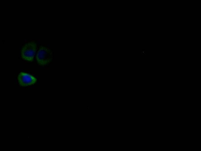 HSD3B1 Antibody in Immunocytochemistry (ICC/IF)