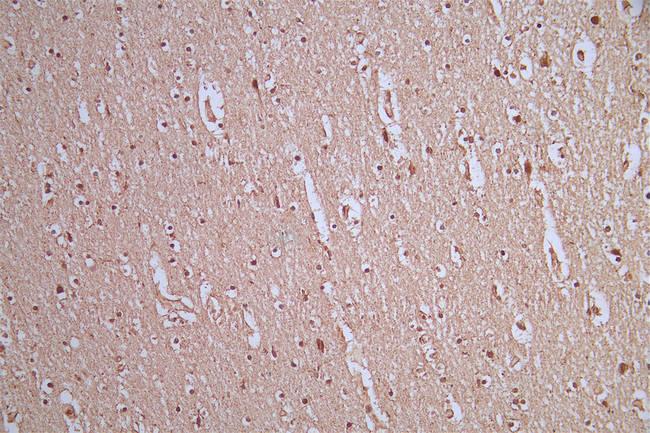 AKT Pan Antibody in Immunohistochemistry (Paraffin) (IHC (P))