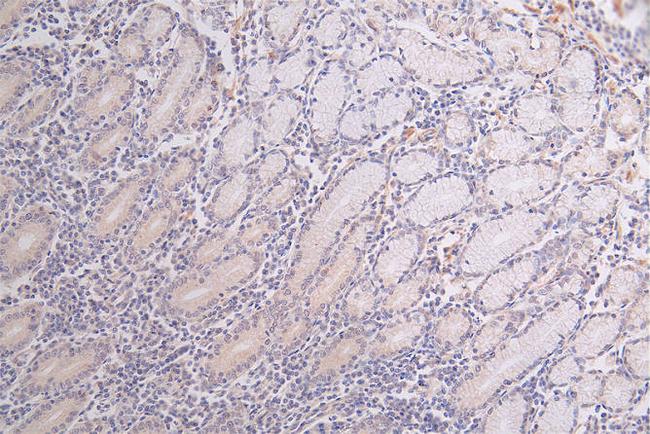 WNK1 Antibody in Immunohistochemistry (Paraffin) (IHC (P))