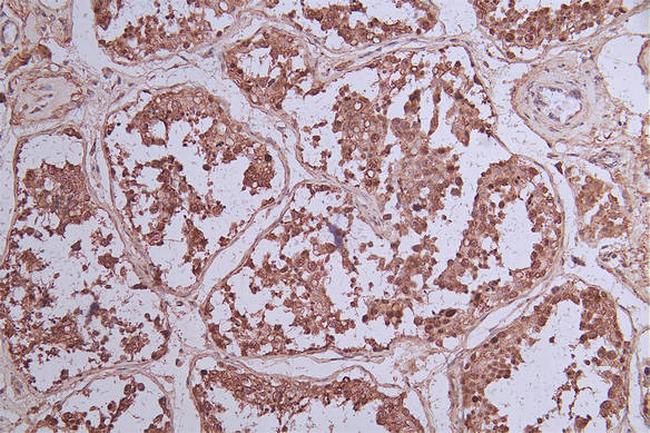 BCL6 Antibody in Immunohistochemistry (Paraffin) (IHC (P))