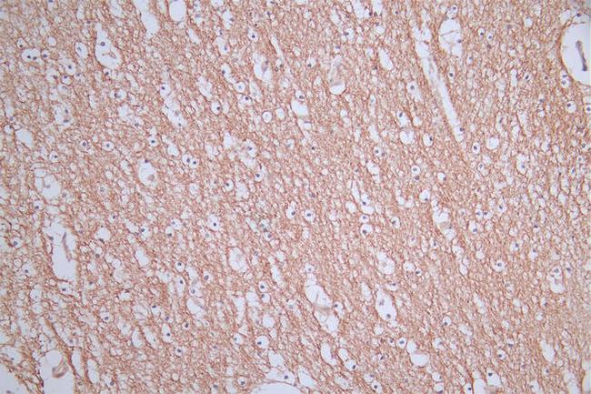 CD171 Antibody in Immunohistochemistry (Paraffin) (IHC (P))