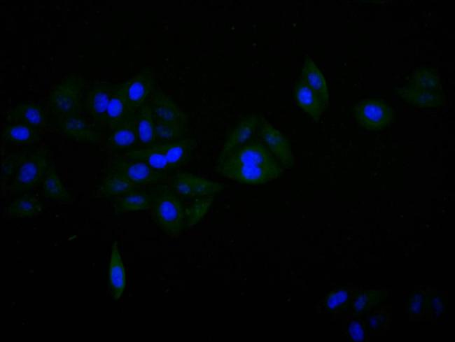 alpha Synuclein Antibody in Immunocytochemistry (ICC/IF)