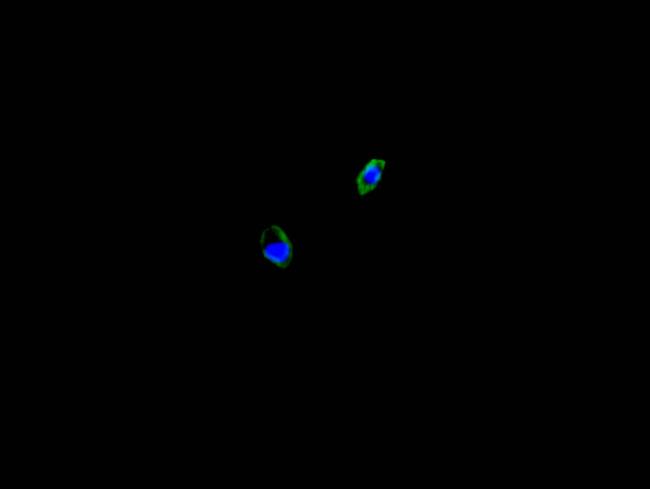 Calreticulin Antibody in Immunocytochemistry (ICC/IF)