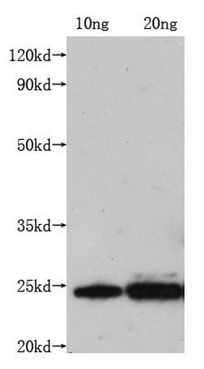 Rabies Virus Matrix Protein Antibody in Western Blot (WB)