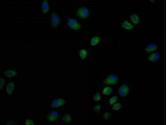 USP6 Antibody in Immunocytochemistry (ICC/IF)