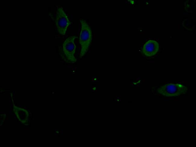 Phospho-PERK (Thr981) Antibody in Immunocytochemistry (ICC/IF)