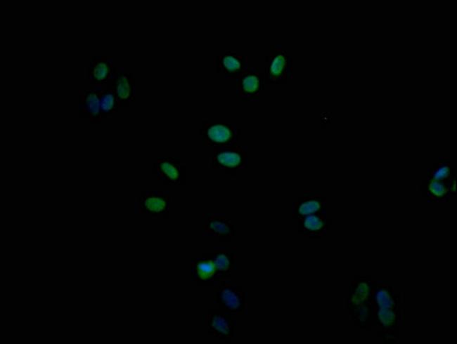 SMURF1 Antibody in Immunocytochemistry (ICC/IF)