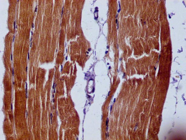 SLN Antibody in Immunohistochemistry (Paraffin) (IHC (P))