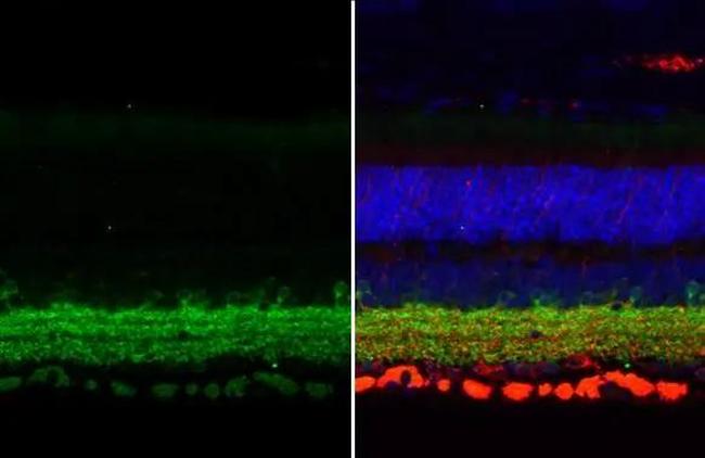 GAD67 Antibody in Immunohistochemistry (Paraffin) (IHC (P))