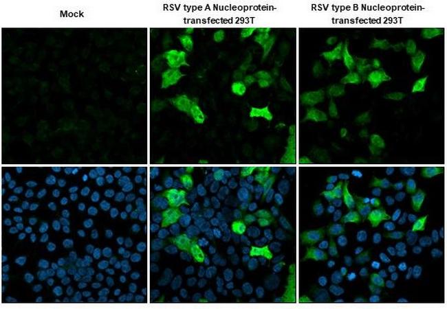 RSV NP Antibody in Immunocytochemistry (ICC/IF)