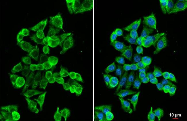 MC1R Antibody in Immunocytochemistry (ICC/IF)