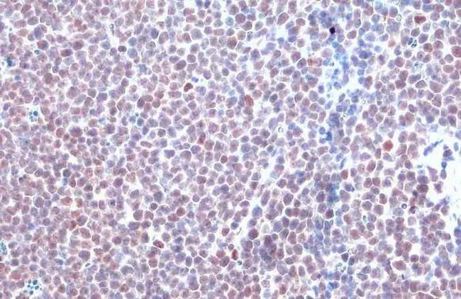 HDAC2 Antibody in Immunohistochemistry (Paraffin) (IHC (P))