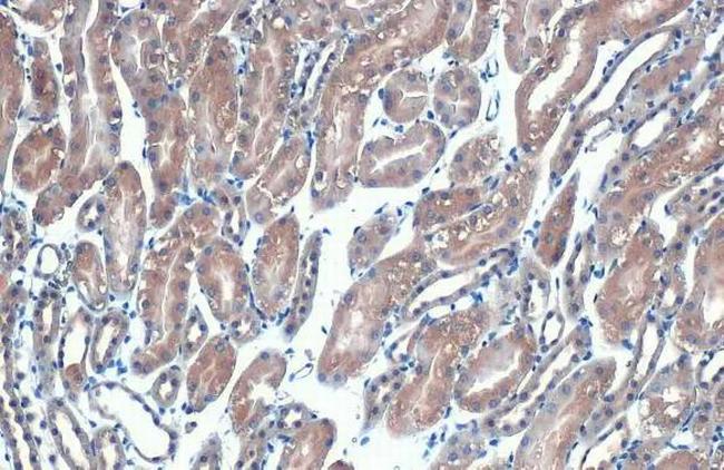 eIF4E Antibody in Immunohistochemistry (Paraffin) (IHC (P))