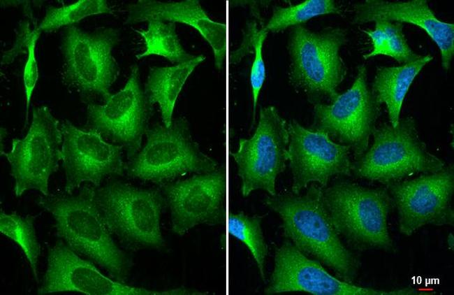 STAM Antibody in Immunocytochemistry (ICC/IF)