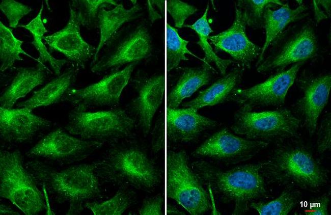 Complement C3 Antibody in Immunocytochemistry (ICC/IF)