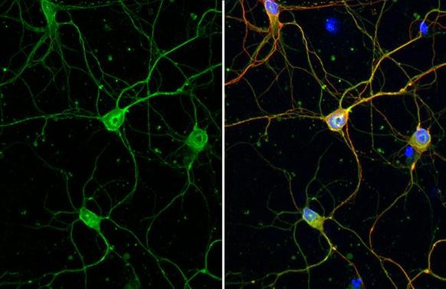 Calbindin/Calretinin Antibody in Immunocytochemistry (ICC/IF)