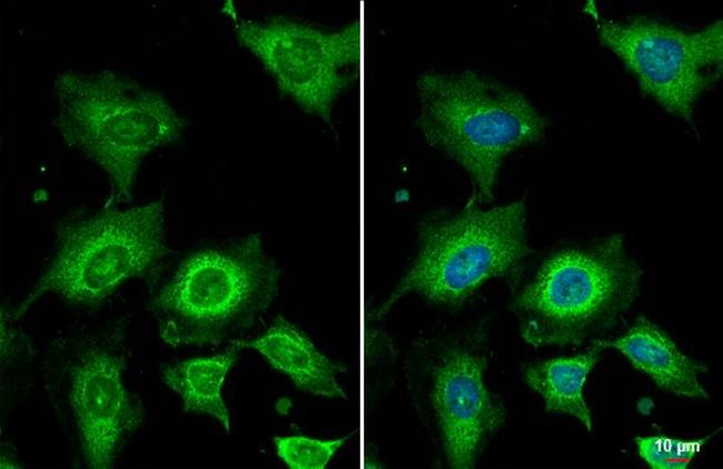 WNT4 Antibody in Immunocytochemistry (ICC/IF)