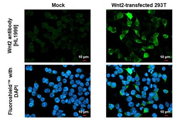 WNT2 Antibody in Immunocytochemistry (ICC/IF)