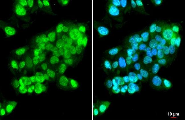 ISG15 Antibody in Immunocytochemistry (ICC/IF)