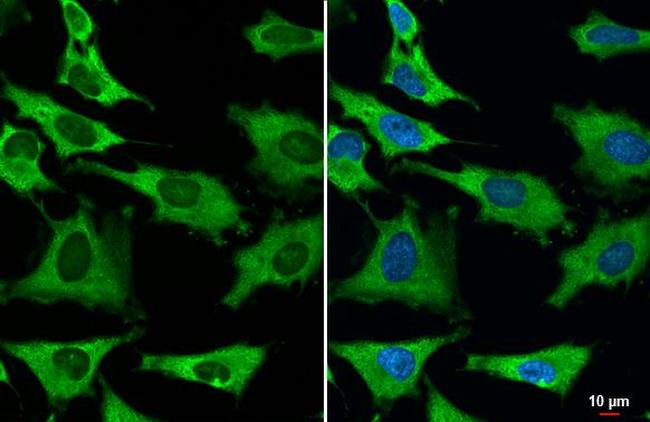 GAPDH Antibody in Immunocytochemistry (ICC/IF)