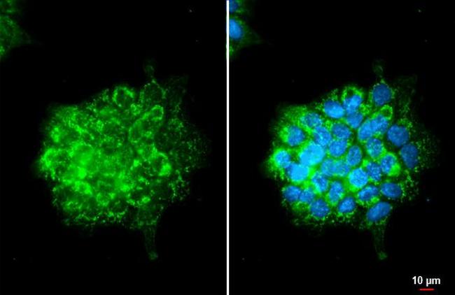 OAT Antibody in Immunocytochemistry (ICC/IF)