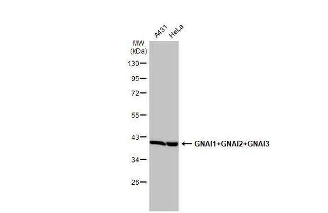 GNAI1/GNAI2/GNAI3 Antibody in Western Blot (WB)