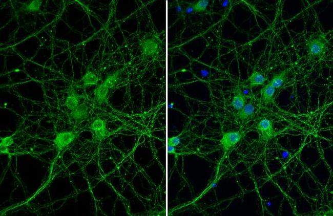 PIN1 Antibody in Immunocytochemistry (ICC/IF)