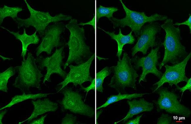 Annexin A1 Antibody in Immunocytochemistry (ICC/IF)