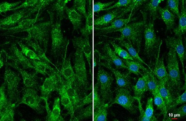 CYR61 Antibody in Immunocytochemistry (ICC/IF)