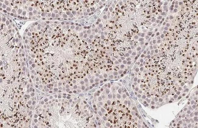 POLE Antibody in Immunohistochemistry (Paraffin) (IHC (P))