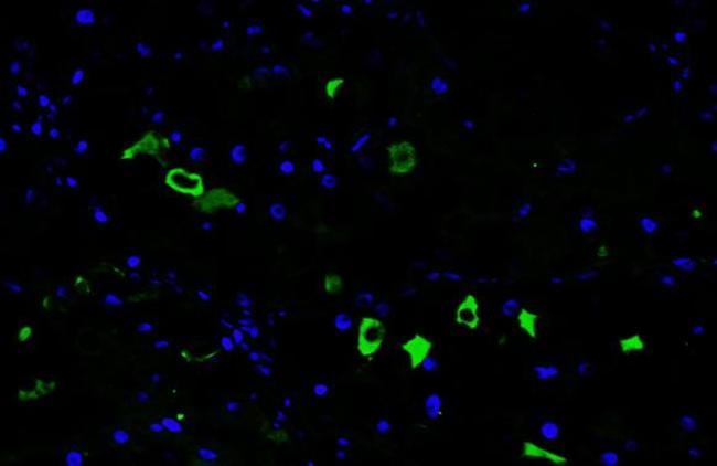 CXCL13 Antibody in Immunohistochemistry (Paraffin) (IHC (P))