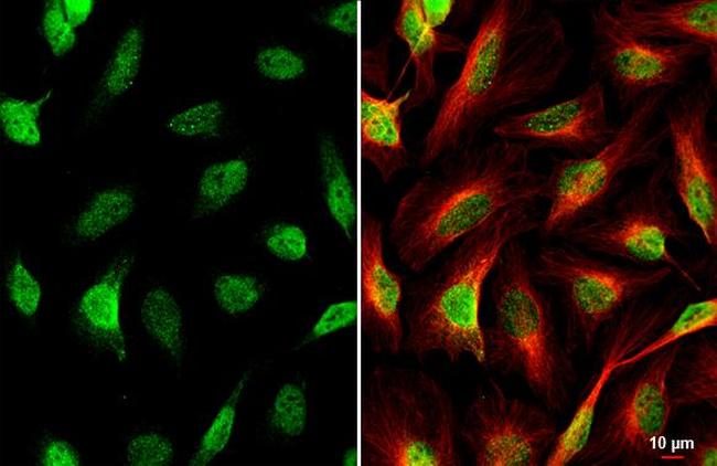 HES1 Antibody in Immunocytochemistry (ICC/IF)