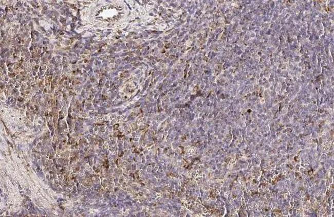 PFKFB4 Antibody in Immunohistochemistry (Paraffin) (IHC (P))