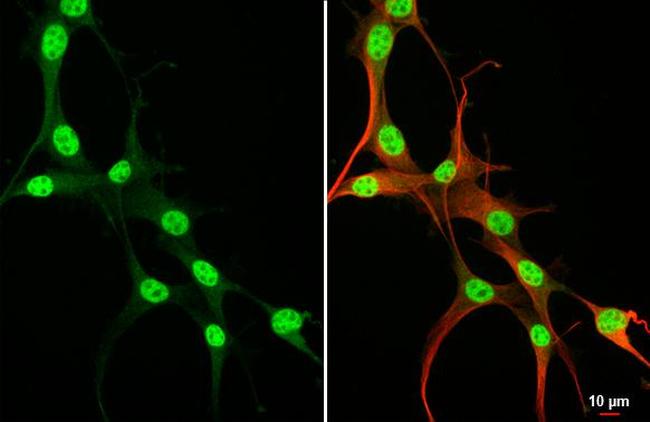 RUNX1 Antibody in Immunocytochemistry (ICC/IF)