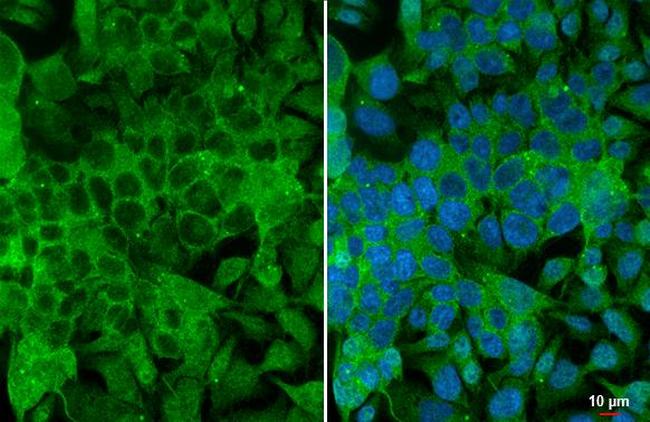 Angiogenin Antibody in Immunocytochemistry (ICC/IF)