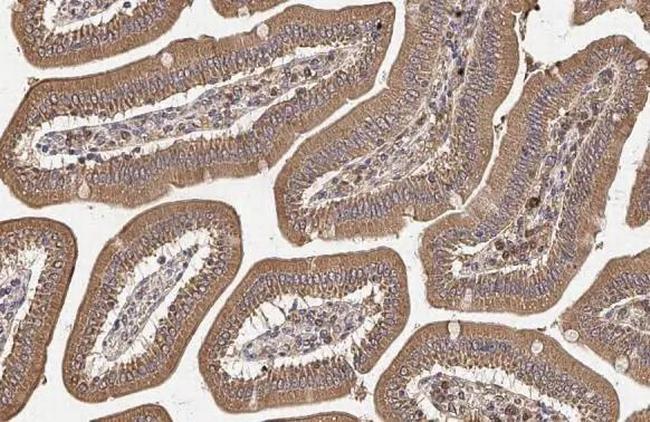 mTOR Antibody in Immunohistochemistry (Paraffin) (IHC (P))