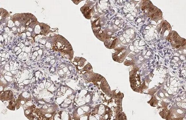 mTOR Antibody in Immunohistochemistry (Paraffin) (IHC (P))