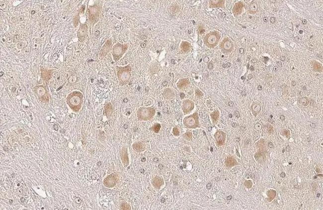 Sigma-1 Receptor Antibody in Immunohistochemistry (Paraffin) (IHC (P))