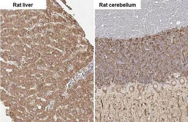 SLC27A2 Antibody in Immunohistochemistry (Paraffin) (IHC (P))